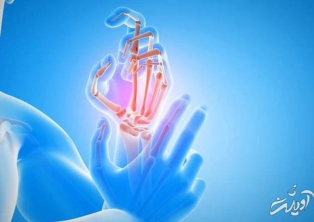 سوزش و بی حسی دست با التهاب رگ ها التهاب رگ دست ها